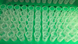 Pipette tips in a tray